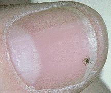 Deer tick